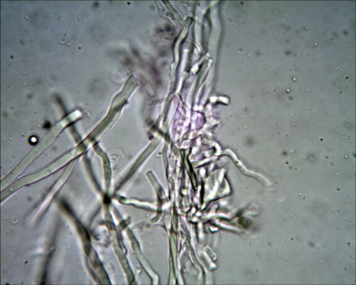 Daedaleopsis tricolor o septentrionalis? (Lenzites betulina)